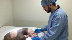 Thousands of lives could soon be saved by pig-organ transplants – here’s how